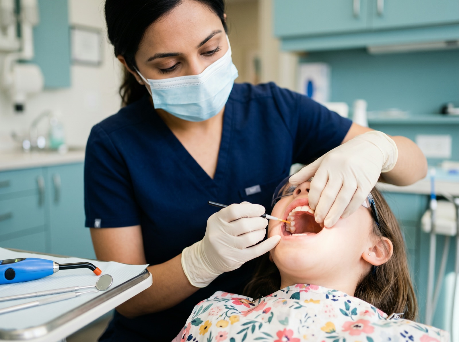 A dentist applying a thin protective sealant to the chewing surface of a back molar with a curing light